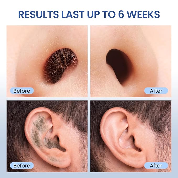 Nose Hard Wax Beads Refill for Men, Nose and Ear Hair Removal, Gentle & Precision Waxing for Sensitive Skin, Portable Home & Travel Wax Beads Only, 100g/3.53oz