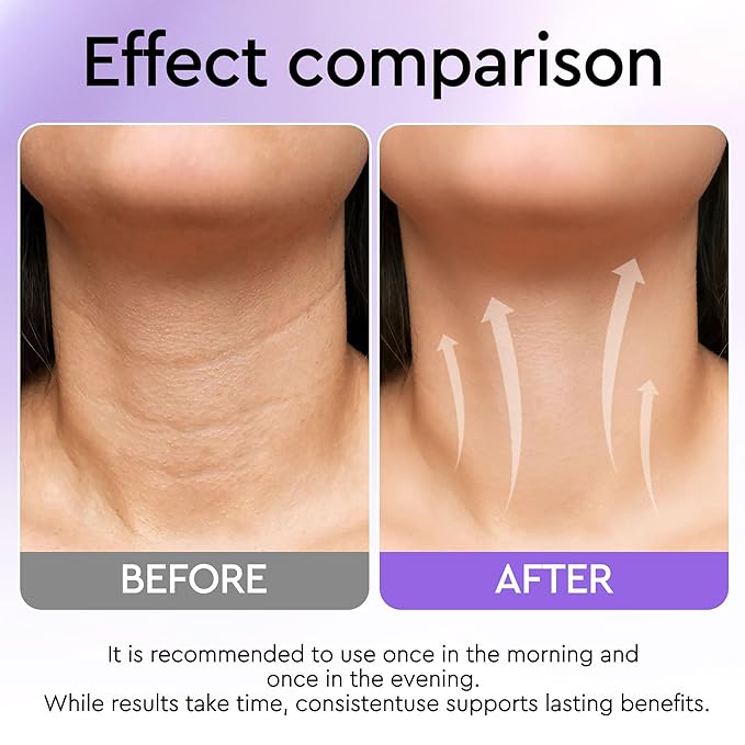 Neck Firming Cream, Retinol Cream for Face&Neck for Tightening Firming Anti-aging Face Moisturizer with Retinol Collagen & Hyaluronic Acid Lift Wrinkle for Women and Men 1.7 Fl. Oz.