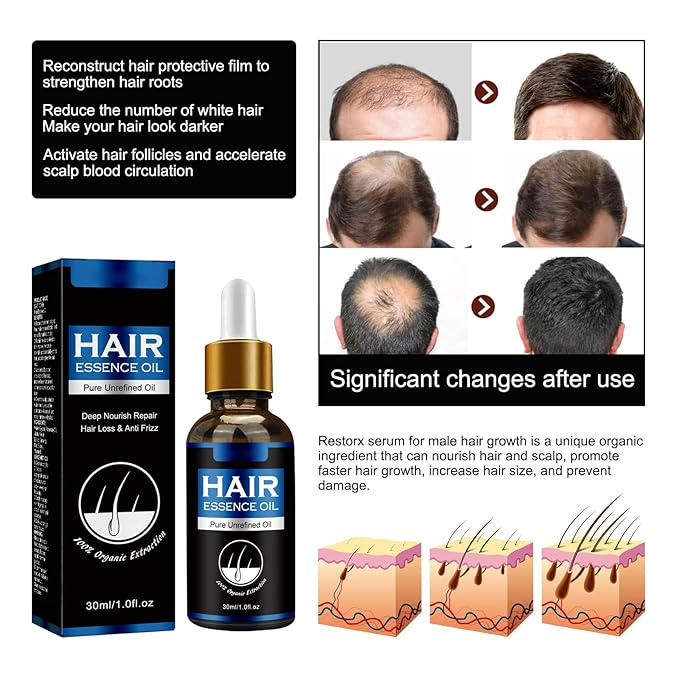 30ml Men's Hair Growth Oil for Thinning Hair – Hair Regrowth Treatment for Balding & Receding Hairline, Natural Hair Thickening Serum with Rosemary & Ginseng