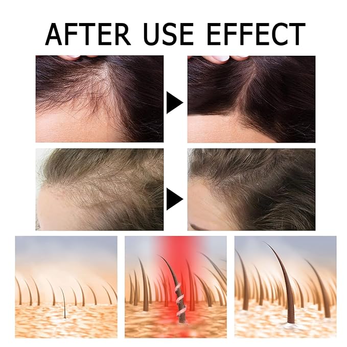 2ml Hair Growth Serum for Thinning Hair & Hair Loss - 7 Count Hair Strength Pro Ampoules with Biotin, Jojoba Oil, Rosemary & Vitamin E - Scalp Treatment to Reduce Shedding & Thicken Hair