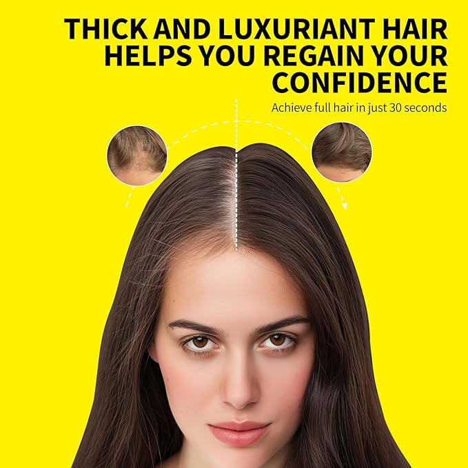 SEVICH Hair Fibers for Thinning Hair, Hair Building Fibers Instantly Thicker & Fuller Look,Hair Powder for Men & Women 40g Dark Brown