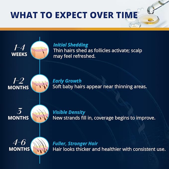 5% Minoxidil Hair and Beard Growth Kit: Extra Strength Minoxidil Topical Hair Regrowth Treatments Serum for Thinning Hair - Hair Loss Products for Men and Women