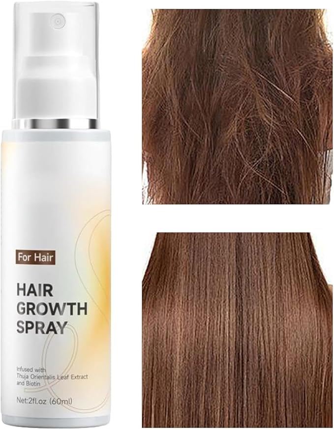 2026 Hair Growth Spray 60ml–Natural Rosemary Oil for Hair Growth,Non-Greasy Anti-Thinning&Hair Loss Prevention,Biotin&Cypress Extract,Lightweight Daily Scalp Spray,for Men&Women (1PCS)