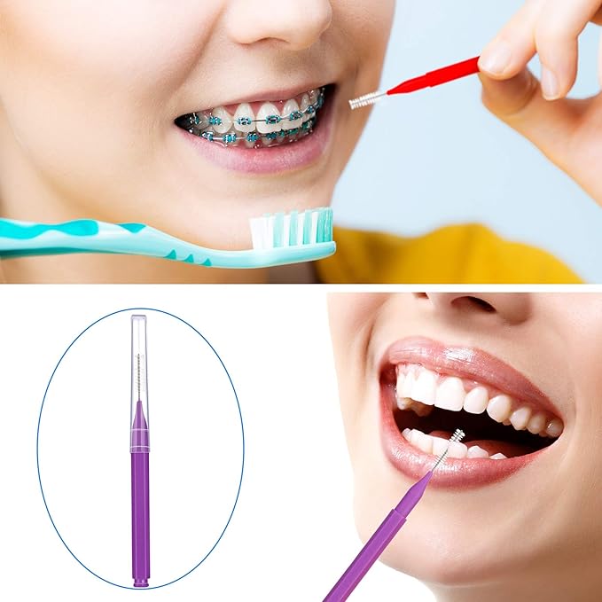 Patelai 100 Pieces Braces Brush for Cleaner Interdental Brush Toothpick Dental Tooth Flossing Head Oral Dental Hygiene Flosser Toothpick Cleaners Tooth Tool(Warm Colors,Various Sizes)