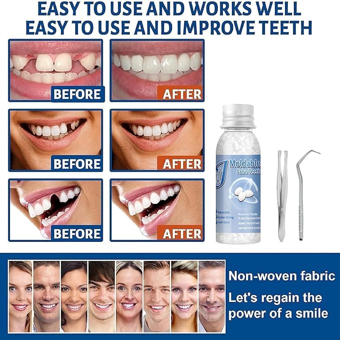 Tooth Repair Kits,2Pcs 30ml Dental Repair Denture Repair Beads,Tweezers,Dental Pick,4Pcs Dental Tools for Filling Missing Broken Tooth Moldable Fake Teeth(2+4Pack)