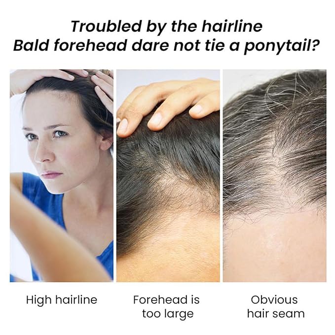 30ml Jojoba Oil Hair Growth Serum for Thinning Hair – Organic Hair Oil for Hair Loss, Dry Scalp & Damaged Hair – Nourishing Scalp Treatment for Men and Women