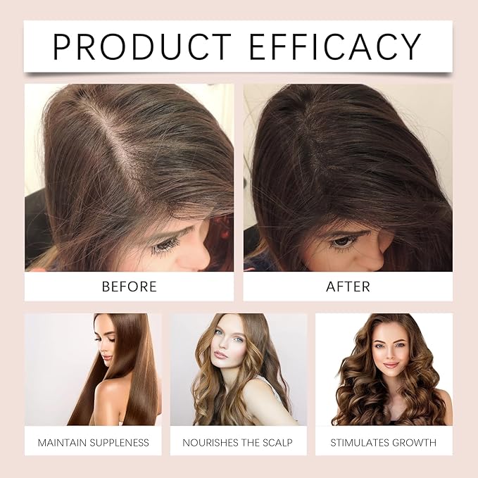 30ml Hair Growth Serum for Thinning Hair – Thickening Scalp Treatment with Rosemary & Castor Oil to Reduce Hair Loss, Nourish Roots & Promote Fuller, Healthier-Looking Hair
