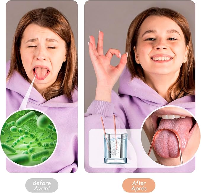 Tongue Scraper 2 Pack, 100% Stainless Steel Tongue Scraper for Adults, Easy to Use Tongue Scraper with Case, Cleaning Tongue and Reducing Bad Breath for Oral Care