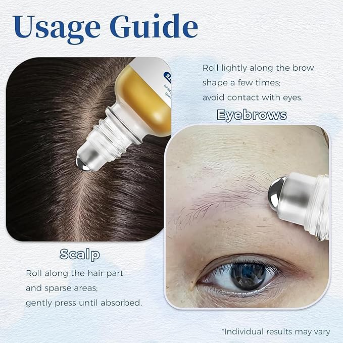 Hair Growth Serum Roll-On for Thinning Hair – Stimulates Follicles, Strengthens Roots & Boosts Density with Rosemary & Biotin – Non-Greasy Scalp Treatment for Men and Women 30ml