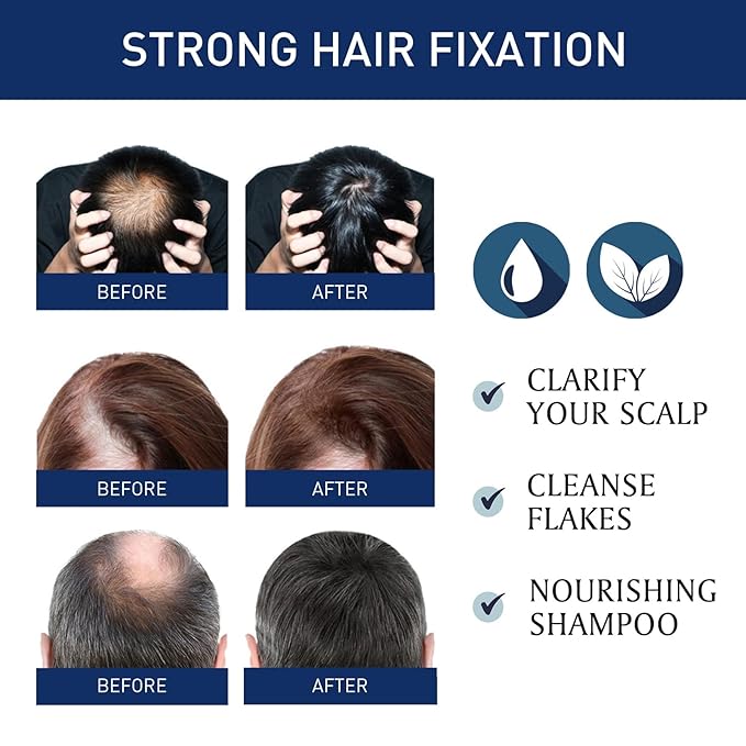 20g Hair Growth Cream for Thinning Hair – Stimulates Follicles, Reduces Hair Loss & Boosts Regrowth for Men and Women – Natural Scalp Treatment for Bald Spots & Receding Hairline