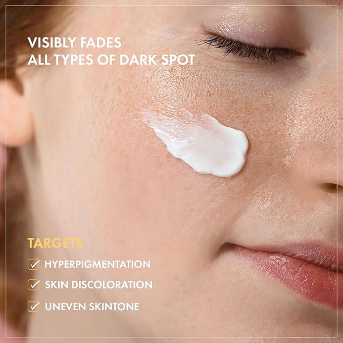 TOSOWOONG 8 Days Spot Cream, Dark Spot Remover for Face, Age Spot, Sun Spot, Freckles, Melasma, Brown Spot Serum, Advanced Formula Corrector Cream with Niacinamide for Women and Men, 50g, 1.76 oz.