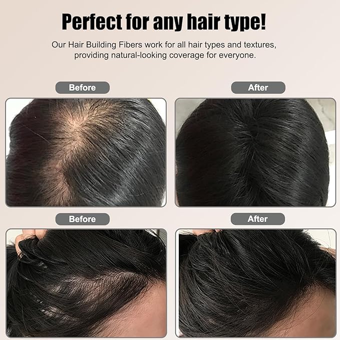 Black Hiar Building Fiber 22g, Hair Fibers for Thinning Hair, Fill In Fine or Thinning Hair Instantly Thicker Fuller Look, Hair Fibers Black for Men & Women