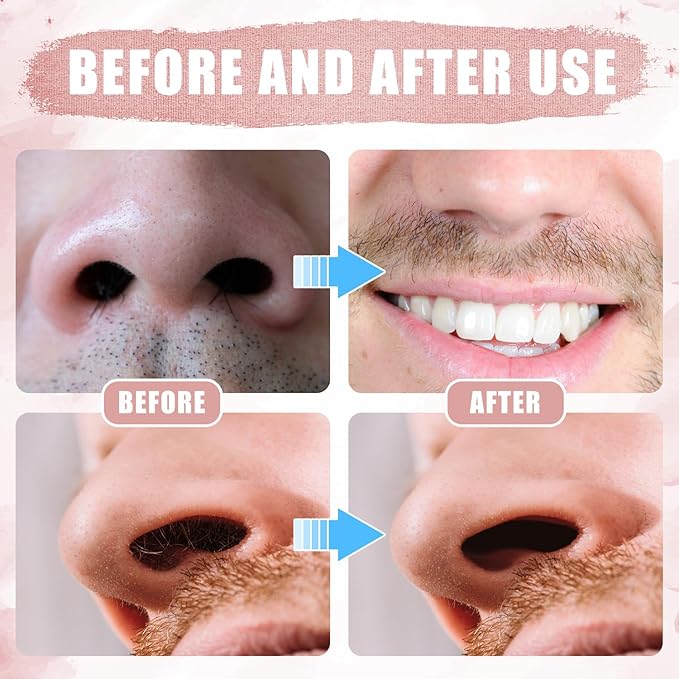 12pcs 2 in 1 Nasal Hair Cutter, 360 Rotating Nose Hair Trimmer for Men Women Double Sided Nose Hair Cleaner with Ear Picker Portable Manual Nostril Hair Removal Tool (Pink)
