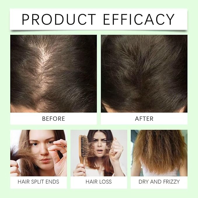 Rosemary Hair Growth Shampoo,Organic Natural Shampoo for Thinning hair & Hair Loss with Hydrolyzed Keratin,Unisex-3.4 fl.oz (Pack of 1)