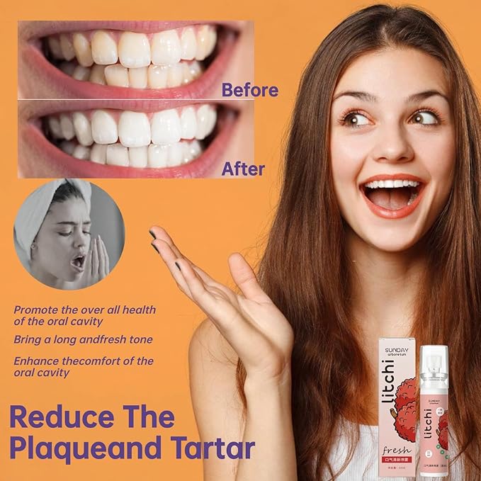 5PCS Oral Breath Spray, Natural Fresh Fruit Breath Freshener Spray, Portable Refreshing Cool Fresh Mint Dry Mouth Spray Bad Breath Treatment Oral Odor Care Spray for Adults