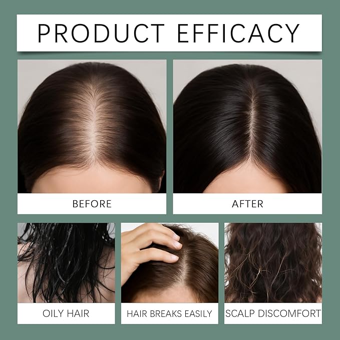 20g Hair Growth Serum for Thinning Hair – Scalp Treatment with Rosemary & Ginseng to Reduce Hair Loss, Strengthen Roots, and Promote Fuller, Healthier-Looking Hair