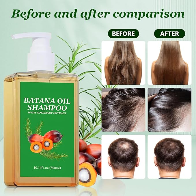 2Pcs Batana Oil Shampoo for Hair Growth,Rosemary Shampoo for Thinning Hair,Nourishing & Regenerating Hair-Soft and Fluffy for Men & Women-10.14 fl oz/Pcs