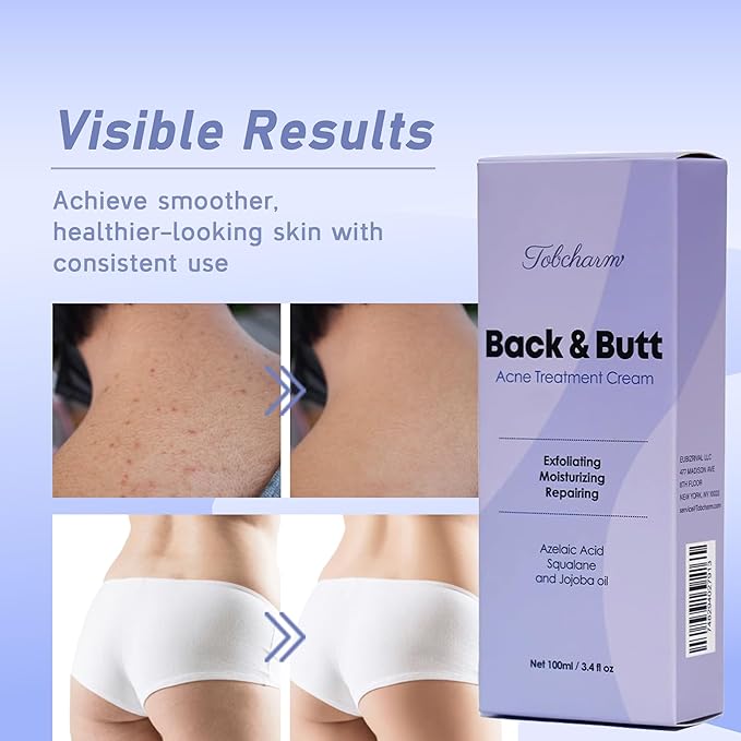 Butt Acne Clearing Treatment, Maximum Strength Body Cream for Back, Buttocks, Thigh & Chest Acne Removal, Skin Clearing Lotion for Men & Women, Foaming Cleanser for Bacne & Cystic Acne