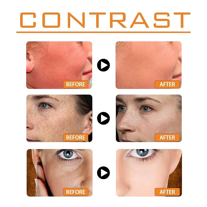 Sunscreen SPF 100, Sunscreen For Body & Face, SPF + Antioxidants, Oil Free, For Sun Sensitive Skin, for Men and Women