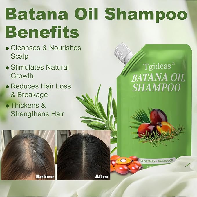 Tgideas Batana Oil & Rosemary Shampoo for Hair Growth, Formula for Thinning Hair & Reduce Hair Loss, Nourish Scalp & Add Volume, for Men & Women (Pack of 2)