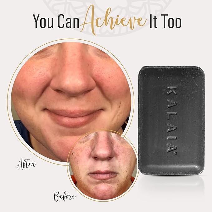Kalaia - Detox & Balance Charcoal Cleansing Bar, Multi-Use Bar Soap with Activated Charcoal, Hydrating Anti-Acne Face Wash in Soap Bar Form, Removes Makeup and Unclogs Pores, 3 oz/85 g