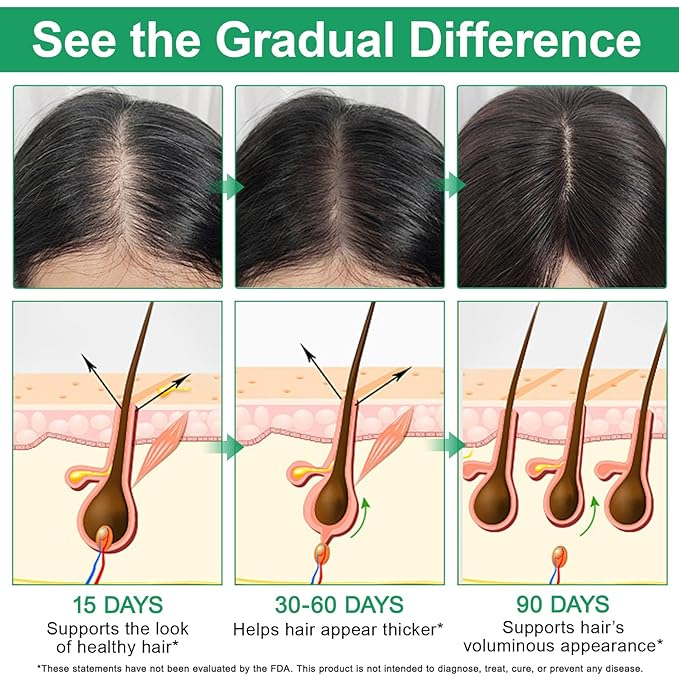 Rosemary Hair Growth Serum Roll On 20 ml – 3% Rosemary, 3% Redensyl, 2% AnaGain, Fast-Absorbing, Non-Greasy, Reduces Hair Fall, For Thinning Hair & All Hair Types (1)