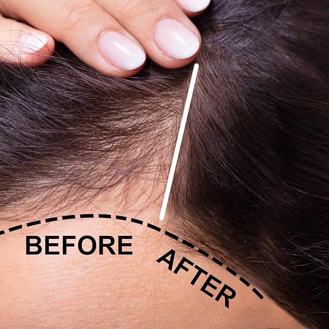 Verseo Sup Hair Growth Conditioner Treatment | Conditioner for Thinning Hair and Hair Loss | Repairing Damaged Hair | 28 Day Supply