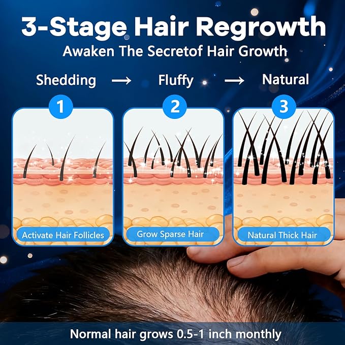 5% Topical Minoxidil Foam, Aerosol Minoxidil for Men, Infused with Biotin, Hair Growth Treatment, Supports Thicker and Fuller Hair & Beard Unscented (Minoxidil Foam, 4.22oz, 2 Months Supply)