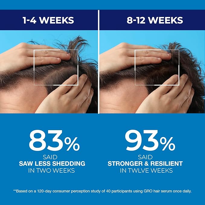 Biotin Hair Growth Shampoo for Men: Thickening & Strengthening Formula for Hair Loss & Thinning Hair, DHT-Blocking Root Activator with Biotin, Caffeine & Tea Tree Oil, 2-Pack (400ML Each)