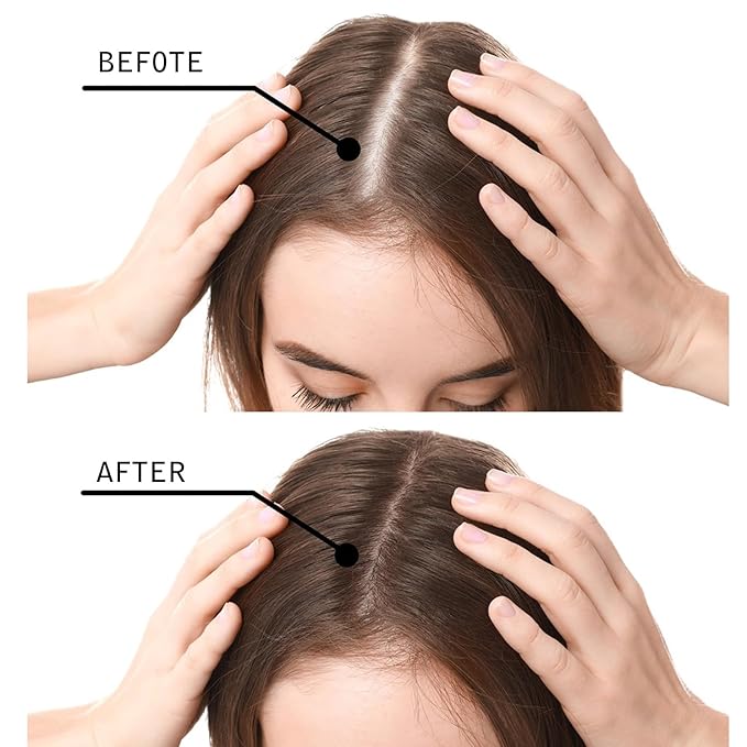 Hair Fibers for Thinning Hair for Women - Black - 27.5g Hair Building Fibers - Instantly Conceals Hair Loss - Revitalize Your Hair, Unlock Thicker, Fuller Tresses