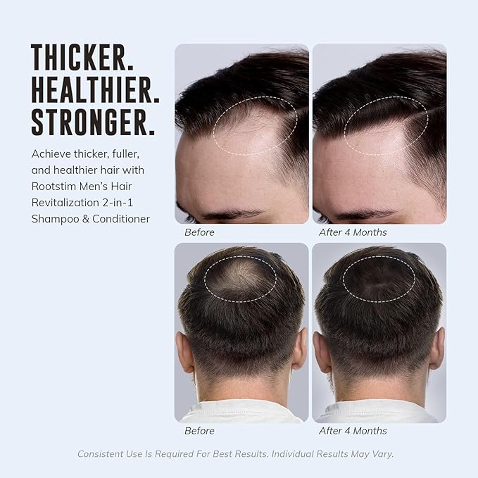 DHT Blocking Shampoo for Men - Hair Thickening & Anti Hair Loss Shampoo with Saw Palmetto, Biotin & Rosemary for Hair Growth - 2-in-1, Sulfate-Free, 10oz