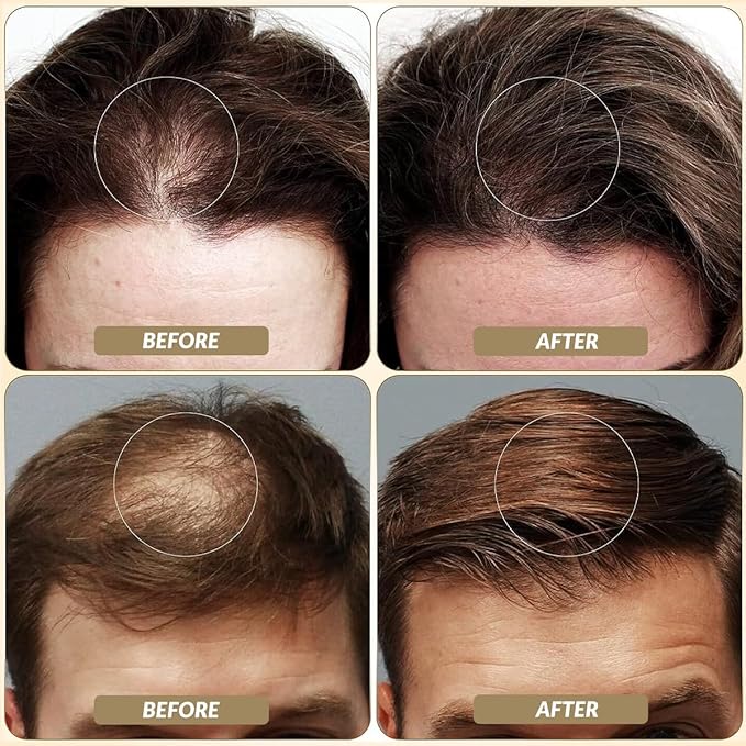 SOVONCARE Hair Fibers for Thinning Hair Gray, Hair Building Fibers for Bald Spots Undetectable & Natural, Conceals Hair Loss Fill In Fine, Hair Powder Hair Thicker Instantly for Women & Men 28g