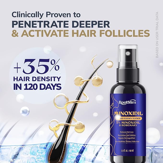 5% Minoxidil Hair Grouth Kit for Men and Women with 0.25 mm Skin Roller – Hair Regrowth Spray & Beard Growth Kit – Targets Thinning Hairlines, Crowns & Patchy Beards – Non-Greasy, Fast-Drying 60ML
