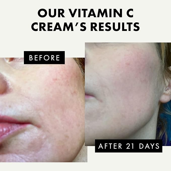 Eclat Skincare Vitamin C Moisturizer for Face with Hyaluronic Acid & Squalane - Face Brightening Cream - Anti Aging, Firming & Hydrating Vitamin C Cream for All Skin Tone 50 ml