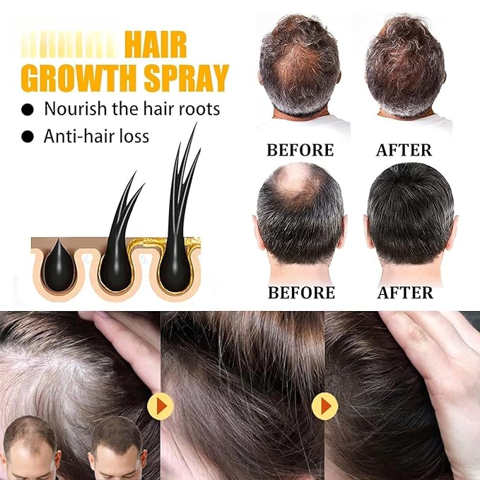 Hair Growth Serum for Women and Men, Hair Follicle Treatment, Hair Care for Germinal Essence Conditioner for Regrowth & Loss Treatment (1cps)