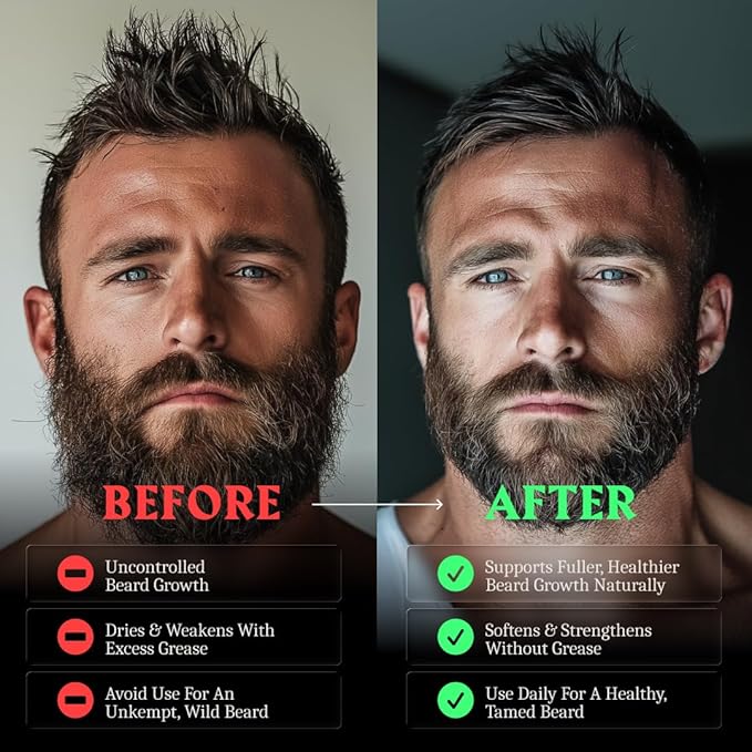 Striking Viking Beard Oil for Men -2 Fl Oz (1 Pack), Bergamot Thunder - Naturally Derived Conditioner with Almond, Tea Tree, Argan & Jojoba Oil for Beard Growth, Softening & Moisturizing