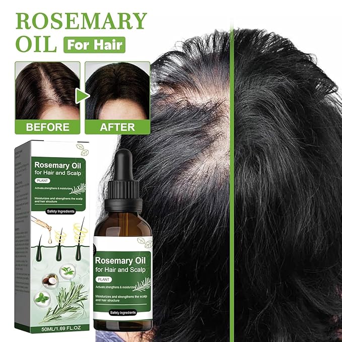 3pcs Rosemary Oil Hair Care Treatment, Natural Rosemary Mint Scalp & Hair Strengthening Oil for Dry, Itchy Scalp, Thickening & Hydration Products for Damaged Hairs & Split Ends (1 Pcs)
