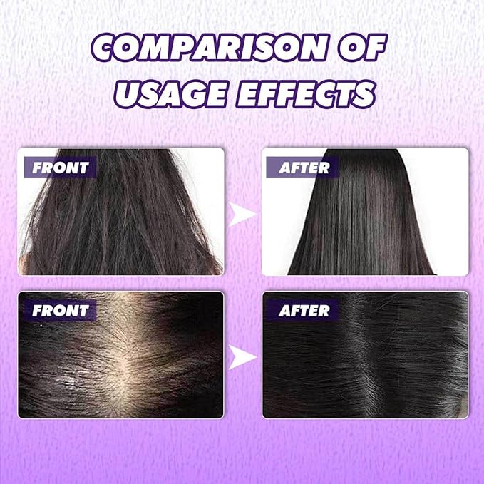Black Rice Water Hair Growth Spray, Hair Growth Serum for Hair Loss Dry Damaged Hair, Deep Moisturizing Strengthening Thickening Smooths Shine Hair Frizz Control For Women Men (1pcs)