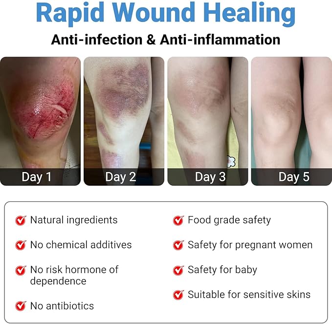 LMNOOP® Wound Care Cream for Infection Ulcers Sores Cuts Scrapes Burns Bites Surgical Open & Deep Wounds and Various Wound, First Aid Skin Repair Ointment for Hard to Heal Wounds on Back Leg Buttock