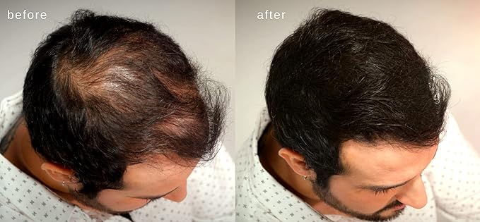 Volumizing Hair Fibers with real Keratin for Thinning Hair/Hair Loss – Dermatologist Tested and Certified Hypoallergenic - 60 days + supply - Multiple Colors Available (Gray)