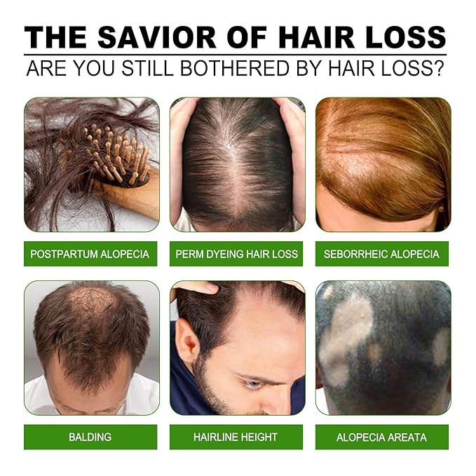 Ginger Hair Care Liquid, Hair Conditioner, Gentle Moisturising Hair, Conditioner for Regrowth & Loss Treatment, Thickness in Thinning Hair and Hair Loss