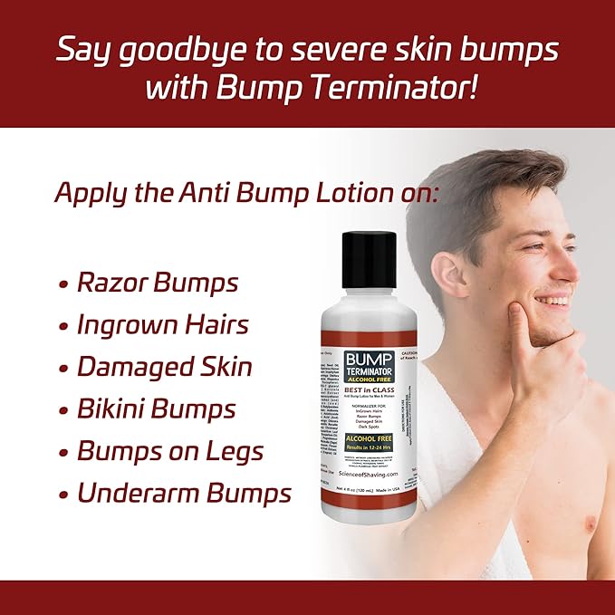 BREEJ Bump Terminator Alcohol-Free Bumps Lotion, Razor Bump Treatment for Men & Women (4 Fluid Ounces)