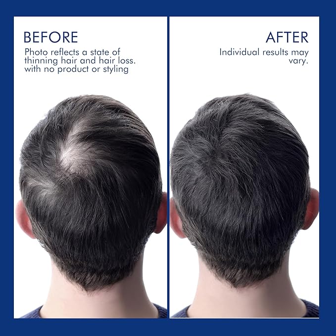 Ceson&Cesun Rosemary & Biotin Hair Growth Thickening Shampoo for Men | Anti-Thinning Hair Strengthening | Hydrate Cleanse Hair & Scalp | Hair Regrowth Shampoo, Dry Damaged Hair Care For Men and Women