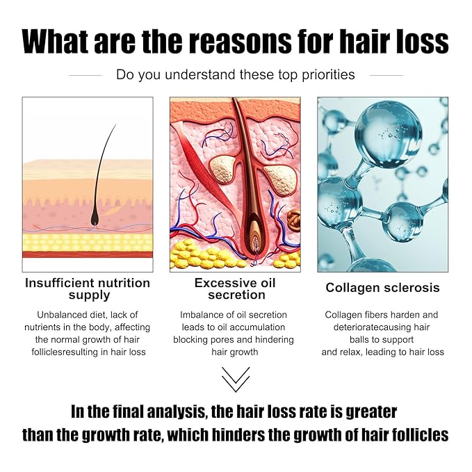 30ml Men's Hair Growth Oil for Thinning Hair – Hair Regrowth Treatment for Balding & Receding Hairline, Natural Hair Thickening Serum with Rosemary & Ginseng