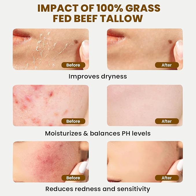 MONIER Whipped Beef Tallow for Skin, Tallow and Honey Balm for Face, Moisturizer with 100% Organic Grass-Fed Beef Tallow & Raw Wild Honey - Packaging May Vary - Dry & Sensitive Skin (Unscented)