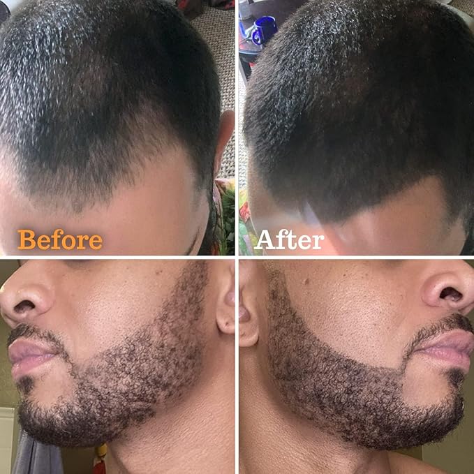 Beard Pen Filler for Men - Barber Styling Grooming Pencil - Waterproof, Sweat Proof, Long Lasting Solution with Natural Finish - Cover Beard and Scalp Patches in Seconds - Medium Brown 5 Pack