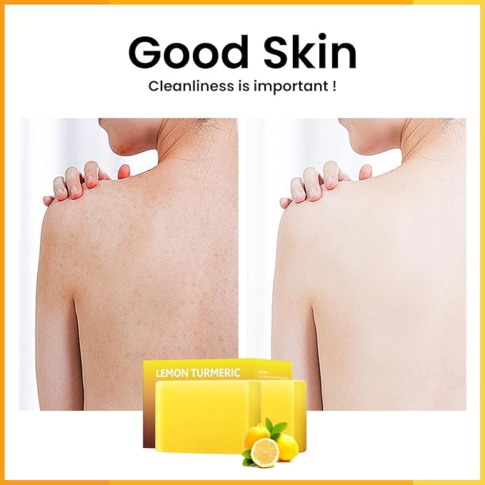 Lemon Turmeric Kojic Acid Soap Bar, Turmeric Soap for Face Body Hands, Deep Cleansing Natural Curcuma Bath Soaps Bar, Moisturizing Facial Cleanser Body Wash for All Skin Types Blemish 2 Bars