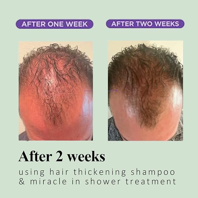 Rosemary & Biotin Shampoo for Hair Growth & Thinning Hair - Sulfate-Free, Vegan Formula with Hydrolyzed Keratin to Thicken, Strengthen & Revitalize Dry, Damaged Hair - For Men & Women (1 bottle)