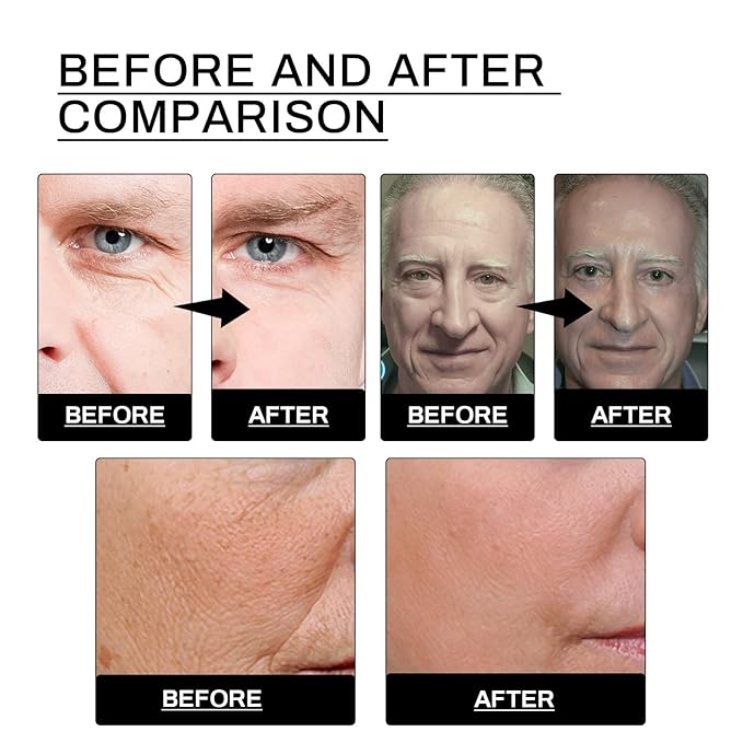 Wrinkle Defence Tallows Balm,Natural Beef Tallows Face Moisturizer,Mens Antiwrinkle&Antiaging Day and Night Cream,Skin Care for Men,Reduce Fine Lines & Wrinkles,Perfect Father's Day Gifts (1pc)