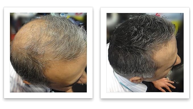 Caboki Hair Building Fiber + Built-In Spray Applicator (30-50 days supply). Salt & Pepper Light